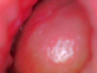 Endoscope Camera Inside My Pink Pussy Records How He Fills Me With Cum💎 - Couple Keyla &amp; Lucas