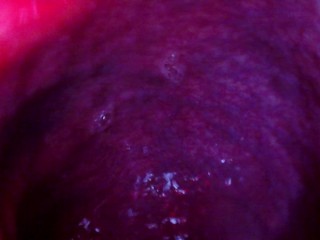 Internal Anal Camera Bad Dragon Flint Fucks My Ass And Cums In A Condoms And Fills My Guts, Heartbea