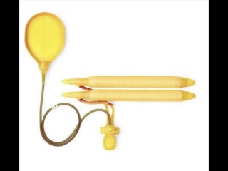 Penile Implant - How to prepare it for great sex?