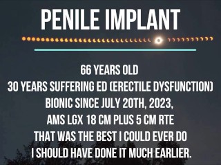 Penile implant, How to use it?